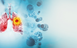 Lung cancerresize