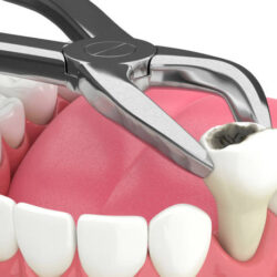istockphoto-1239799244-612x612