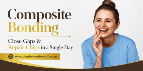 Composite Bonding Close Gaps & Repair Chips in a Single Day Composite Bonding Close Gaps & Repair Chips in a Single Day