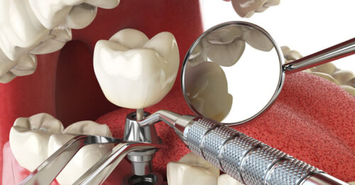 affordable oral surgery affordable oral surgery