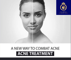 Acne Image (2) (1)
