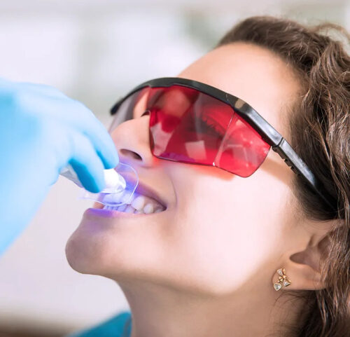 dental_services_smile_design_dentistry_004