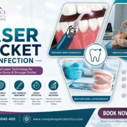 Is Laser Pocket Disinfection Worth It