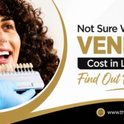 Not Sure What Veneers Cost in London Find Out Right Here
