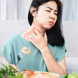 Food Allergy Treatment