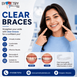 Clear_Braces_optimized_1000
