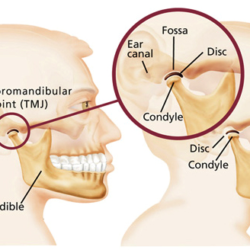 holistic tmd treatment