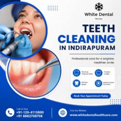 teeth-cleaning-in-indirapuram