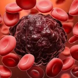 blood-cancer-1