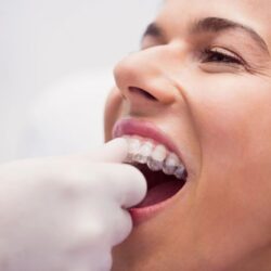 Orthodontist bellerose