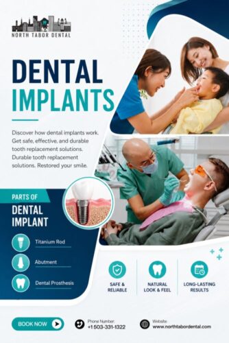 How Dental Implants Work How Dental Implants Work