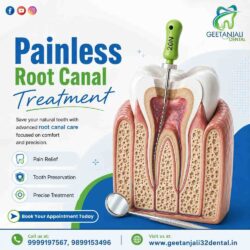Painless Root Canal Treatment-Geetanjali-jpg