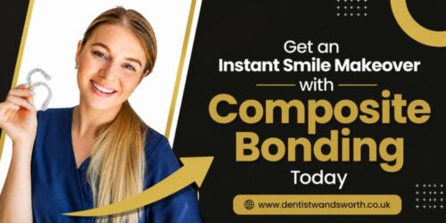 Get an Instant Smile Makeover with Composite Bonding Today Get an Instant Smile Makeover with Composite Bonding Today