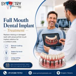 Full mouth dental implants near me