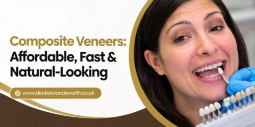 Composite Veneers_ Affordable, Fast & Natural-Looking Composite Veneers_ Affordable, Fast & Natural-Looking