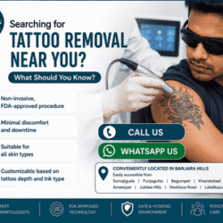 Tattoo_Removal_Treatment_near_Jubilee_Hills_1_optimized_250