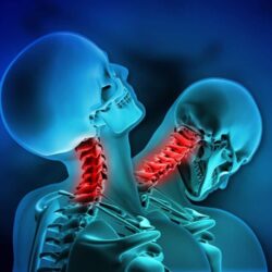 imgi_138_whiplash-illustration