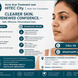 Acne_Scar_Treatment_near_H_ITEC_City_optimized_250