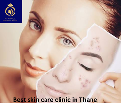 Best skin care clinic in Thane (2) (1)