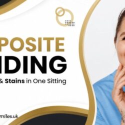 Composite Bonding Fix Chips, Gaps & Stains in One Sitting