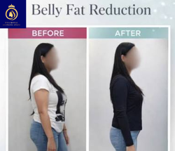 Fat reduction in Thane (2) (2)