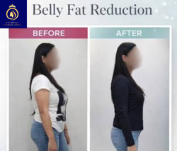 Fat reduction in Thane (2) (1)