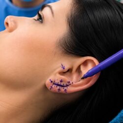 earlobe