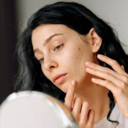face-lifting