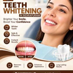 Teeth Whitening Treatment in Indirapuram for a Brighter Smile-100kb