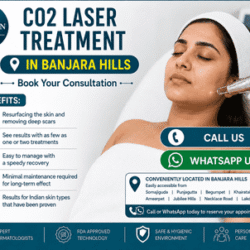 CO2_Laser_Treatment_in_Banjara_Hills_optimized_250