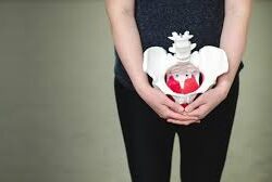 pelvic floor physiotherapy