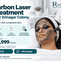 Carbon_Laser_Facial_near_Srinagar_Colony_1_2_optimized_250
