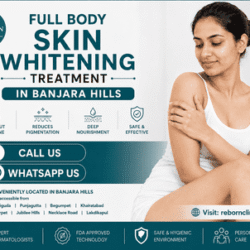 Full_Body_Skin_Whitening_Treatment_in_Banjara_Hills_1_optimized_250