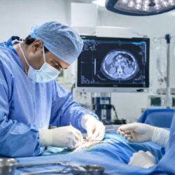 What Is Surgical Oncology A Complete Guide to Cancer Surgery