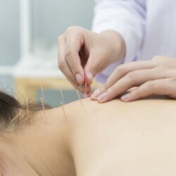 9 acupuncture for neck pain nyc