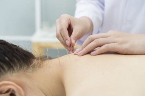 9 acupuncture for neck pain nyc 9 acupuncture for neck pain nyc
