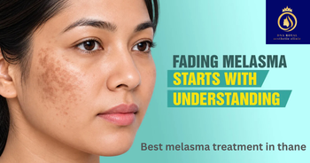 Best melasma treatment in thane (1) (1) Best melasma treatment in thane (1) (1)