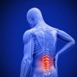 back pain