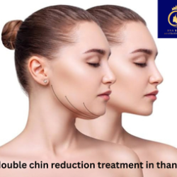 double chin reduction treatment in thane (1) (1)
